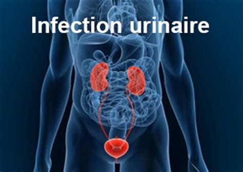 sodomie infection urinaire|Pourquoi jai une infection urinaire après chaque rapport sexuel